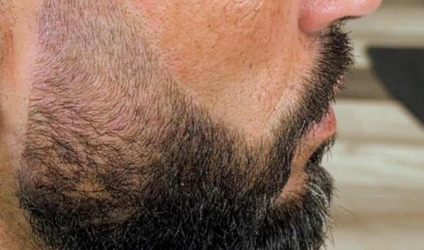 Beard Trimming